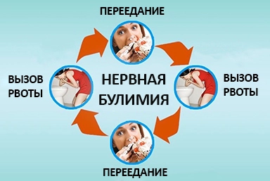 Лечение булимии в Беломорске